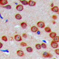 Polyclonal Rabbit anti-Human MTG2 / GTPBP5 Antibody (Internal, IHC, WB)