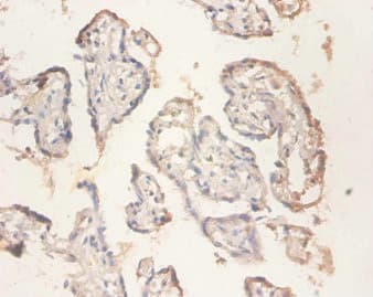 Polyclonal Rabbit anti-Human RPS11 / Ribosomal Protein 11 Antibody (IHC, WB)
