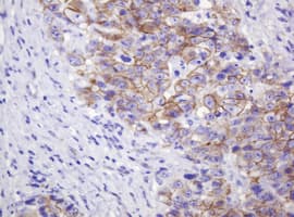 CTNND1 / p120 Catenin Antibody (clone OTI2E8)