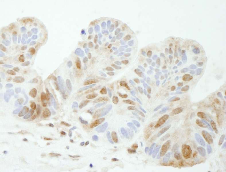 TDP1 Antibody (aa1-50)