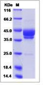 Human MSLN / Mesothelin Protein (Recombinant)