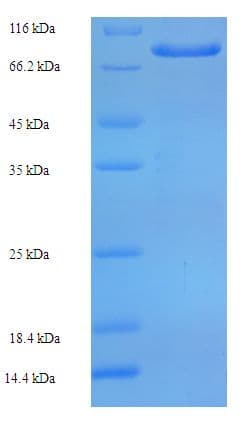 Human ARSG / Arylsulfatase G Protein (Recombinant His-SUMO)