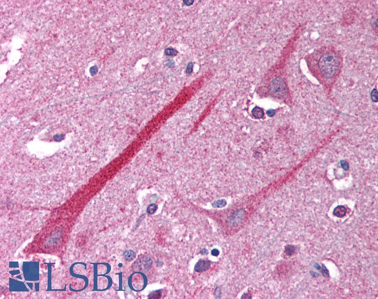 IHC-plus™ Polyclonal Rabbit anti-Human TNFRSF14 / CD270 / HVEM Antibody (IHC, IF, WB)
