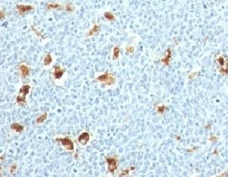 S100A9 / MRP14 Antibody (clone S100A9/1011)