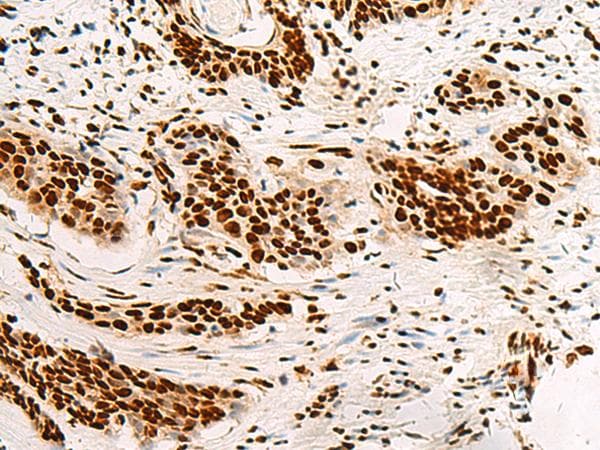 Polyclonal Rabbit anti-Human HNRNPA3 / HnRNP A3 Antibody (IHC, WB)