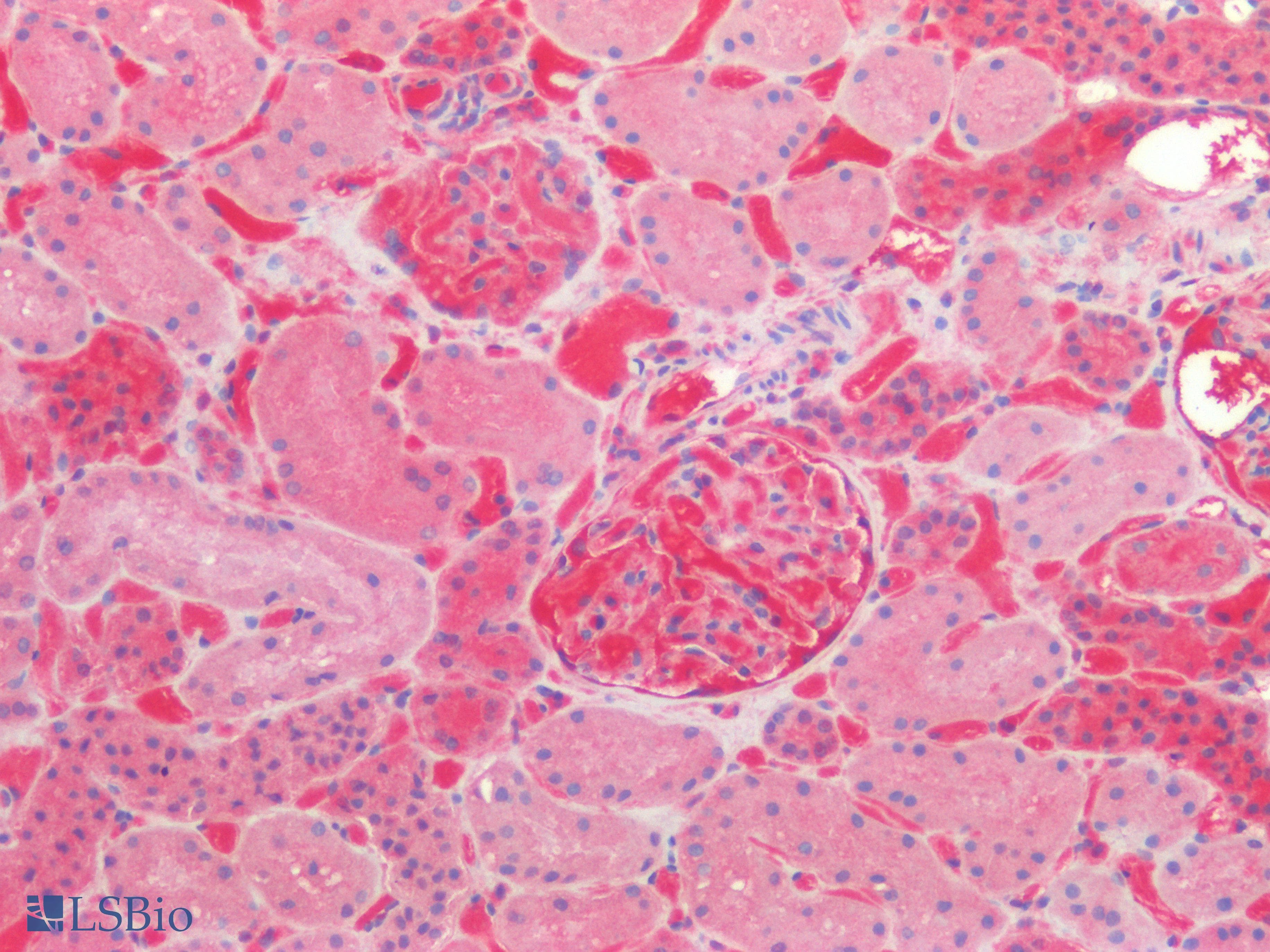 IHC-plus™ LAMA1 / Laminin Alpha 1 Antibody