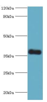 CALHM1 Antibody (aa202-346)