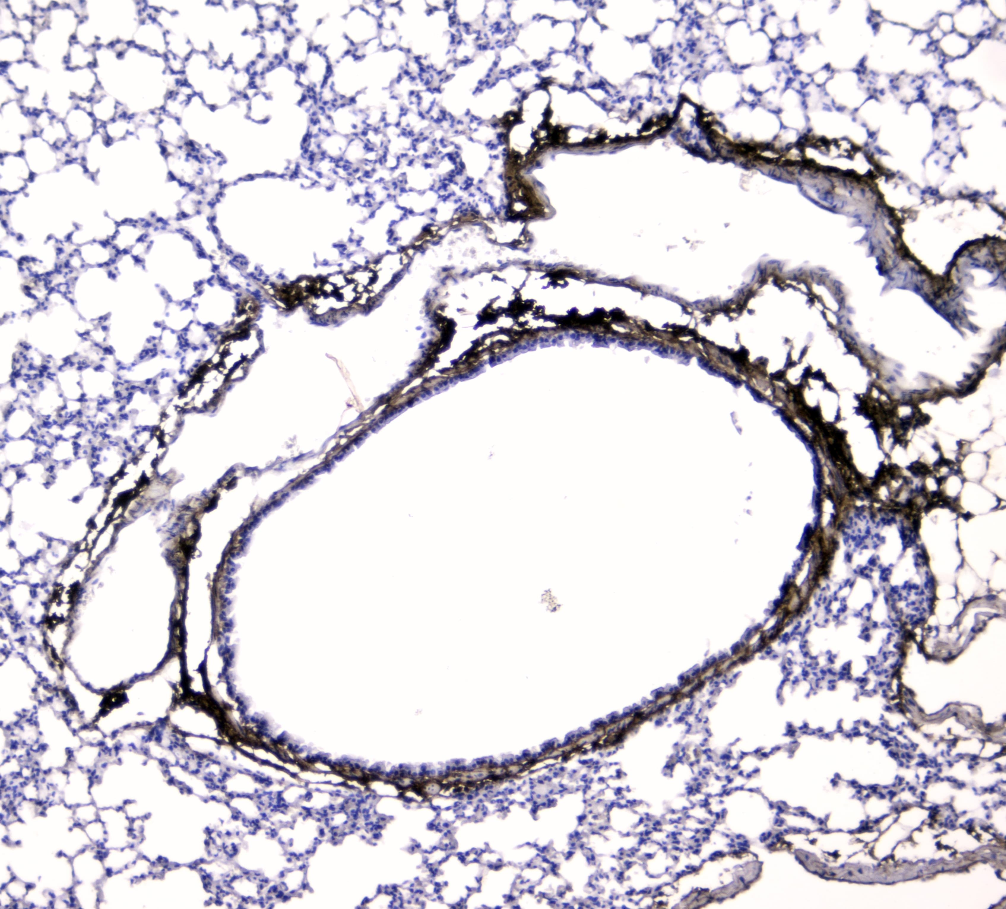 COL1A1 / Collagen I Alpha 1 Antibody (aa1192-1207)
