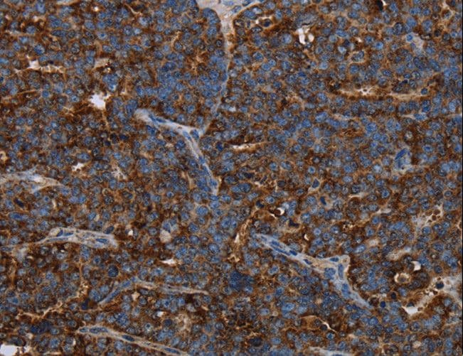 HMGCL Antibody