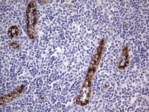 VWF / Von Willebrand Factor Antibody (aa764-1263, clone OTI6C7)