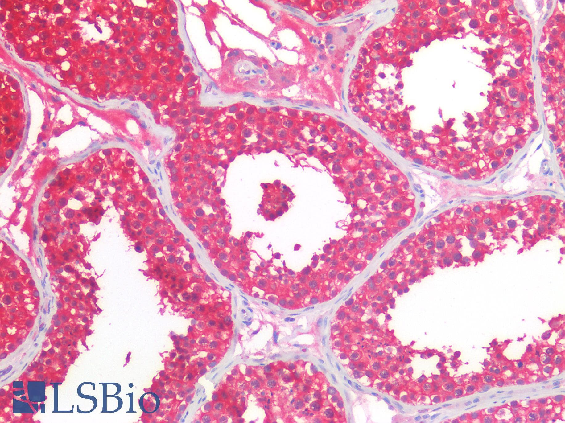 IHC-plus™ HPRT1 / HPRT Antibody (clone AT1D9)