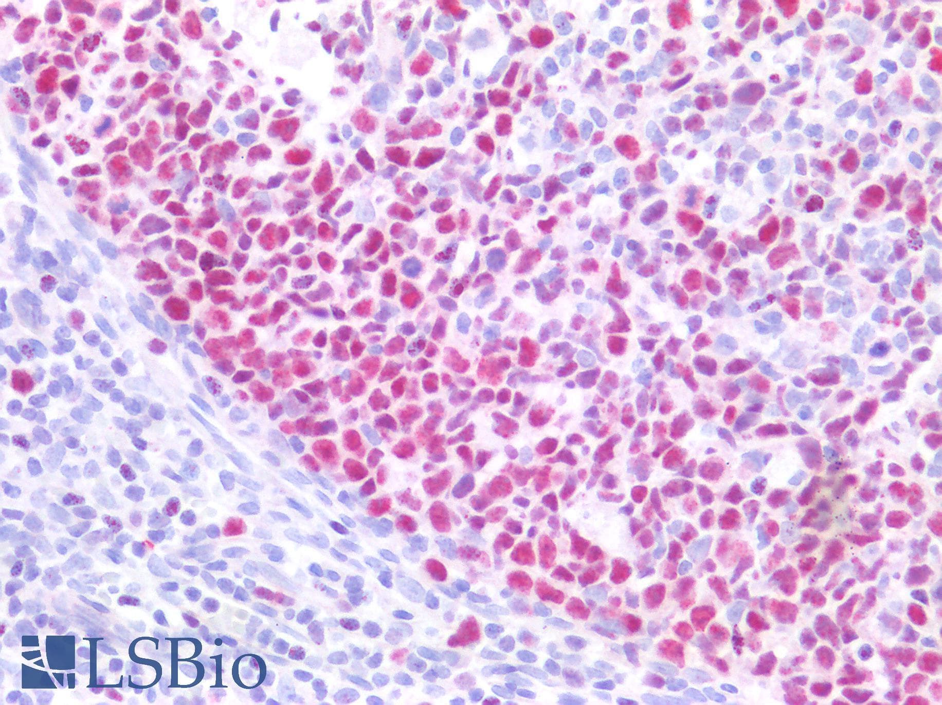 PathPlus™ MCM3 Antibody