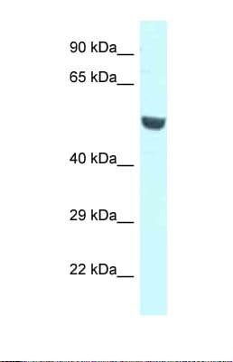 CNKSR1 Antibody (aa165-214)