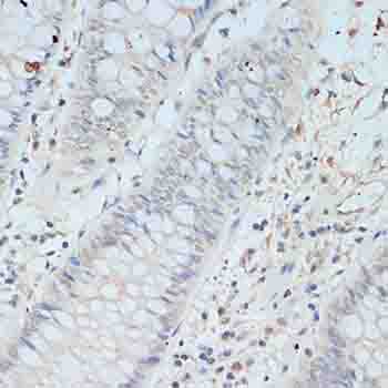 TCEB2 / Elongin B Antibody