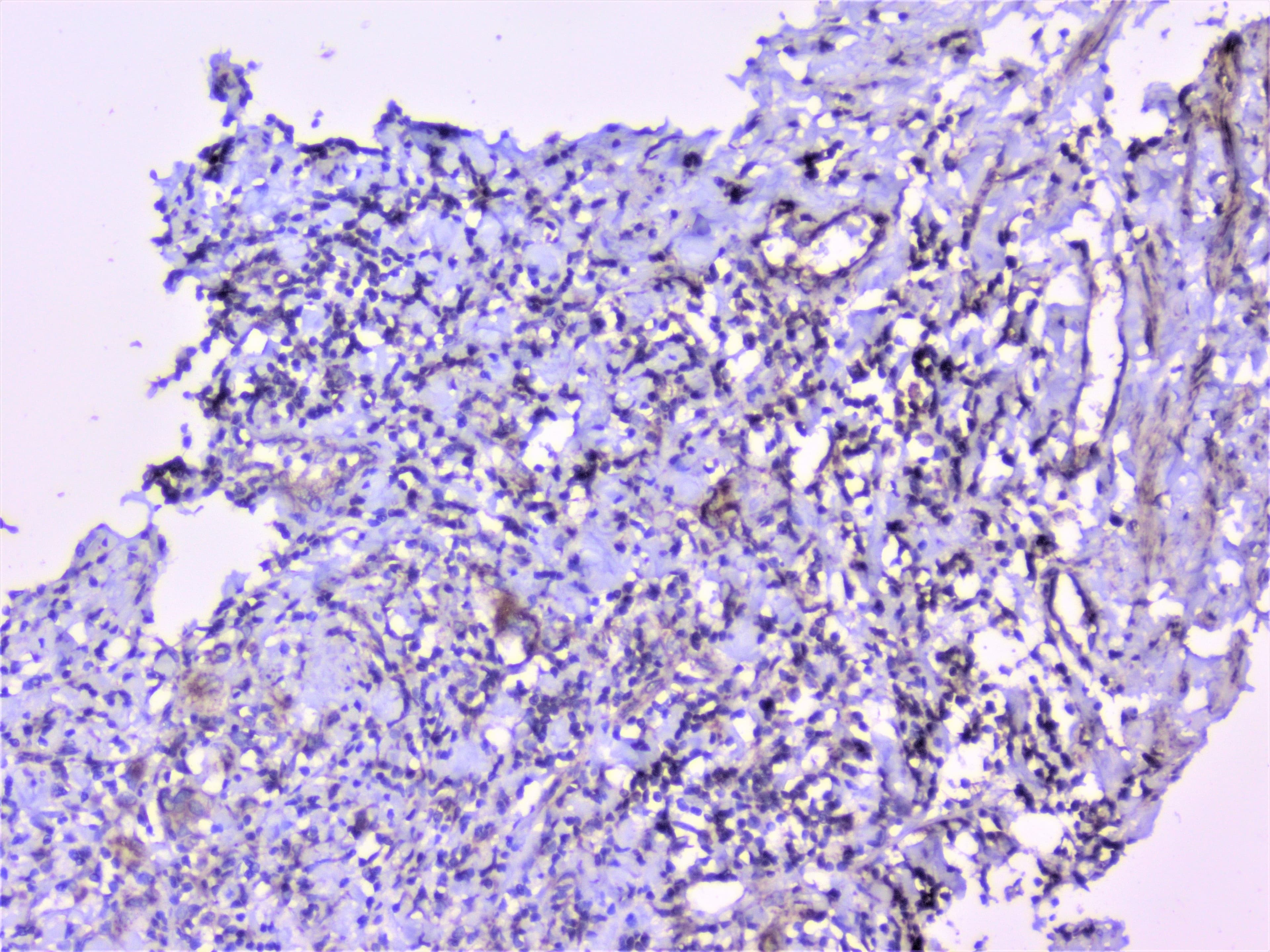 CTTN / Cortactin Antibody