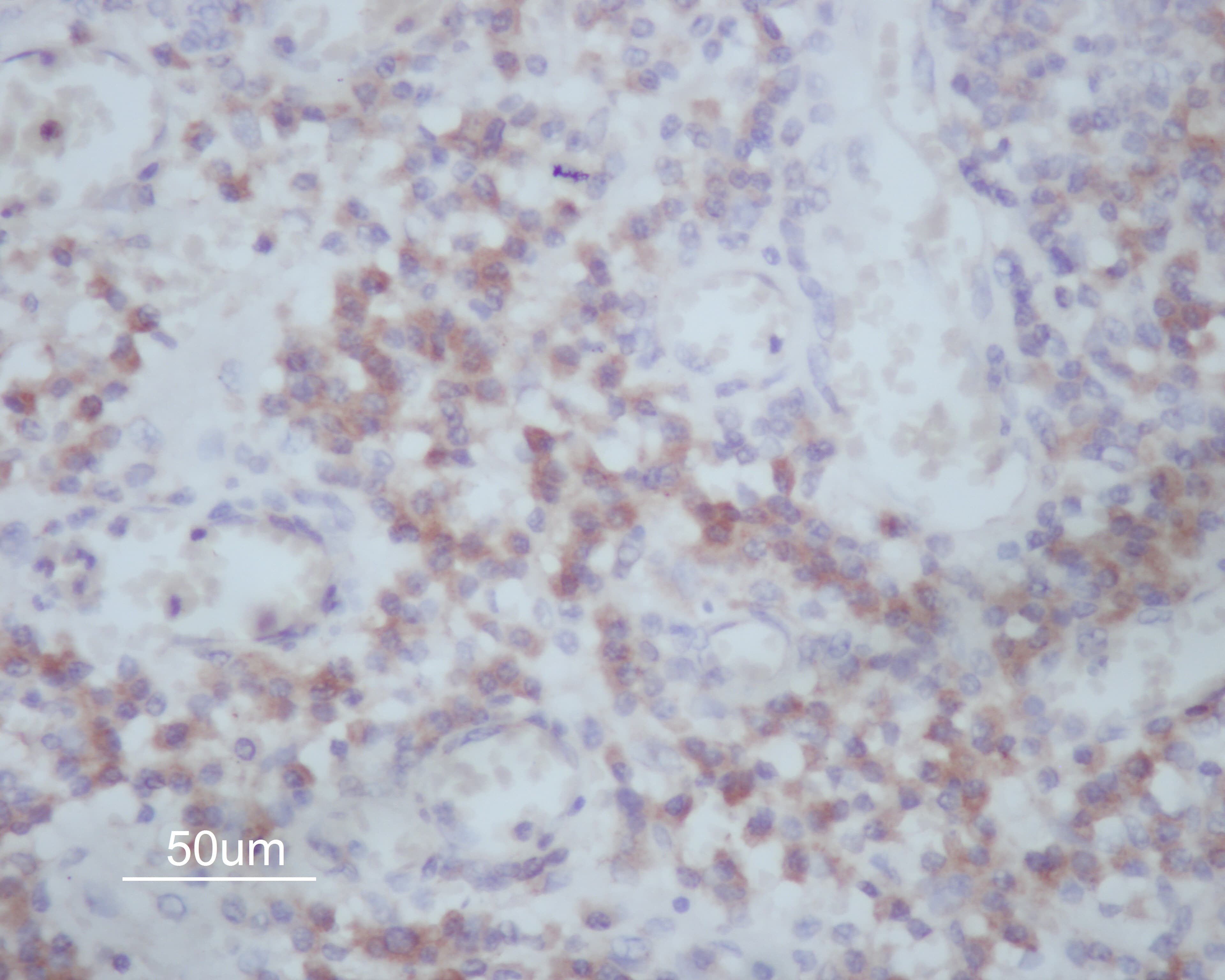 Polyclonal Rabbit anti-Human MMP14 Antibody (IHC, IF, WB)