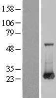 RAB6A / RAB6 Protein (Over-Expression Lysate Myc-DDK (Flag))