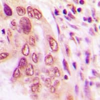 NIX / BNIP3L Antibody