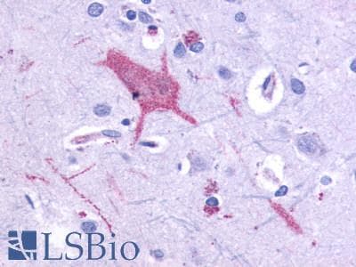 PathPlus™ Polyclonal Rabbit anti-Human GRM1 / MGLUR1 Antibody (C-Terminus, IHC)