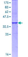 Human ITPR1 / IP3 Receptor Type 1 Protein (Recombinant GST, N-terminus)