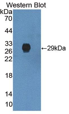 IVD Antibody