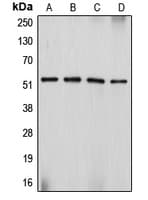 DES / Desmin Antibody (C-Terminus)