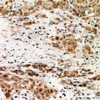 Polyclonal Rabbit anti-Human C6orf150 / MB21D1 Antibody (IHC, WB)