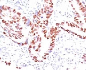 CDKN1C / p57 Kip2 Antibody (clone KIP2/880)