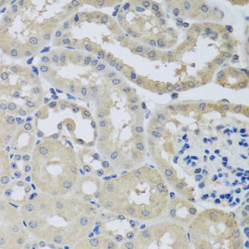 CHMP1B Antibody