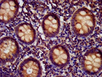HEDLS / EDC4 Antibody