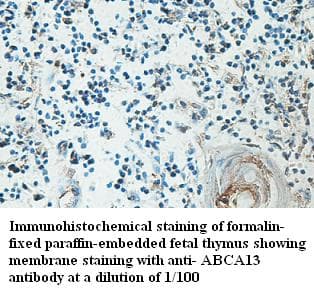 Polyclonal Rabbit anti-Human ABCA13 Antibody (IHC)