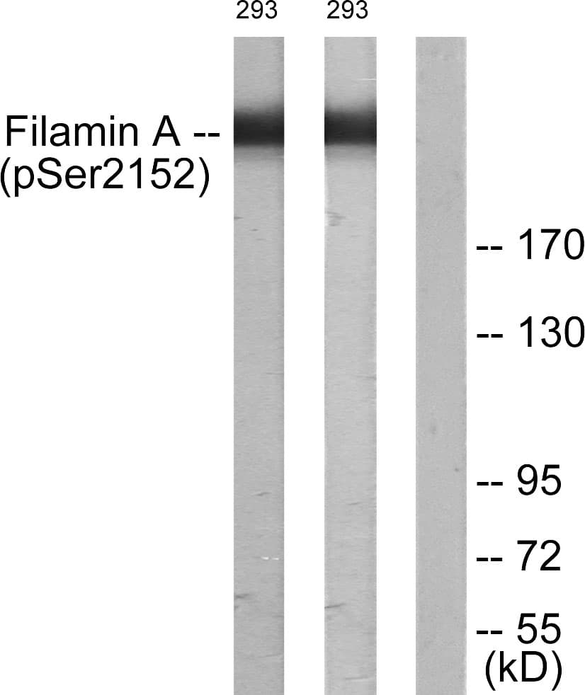 FLNA / Filamin A Antibody (phospho-Ser2152)