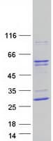 Human IP6K2 Protein (Recombinant Myc-DDK (Flag))
