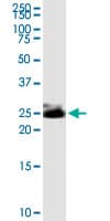 THY1 / CD90 Antibody (clone 3F9)