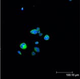 HSPB1 / HSP27 Antibody (phospho-Ser15)