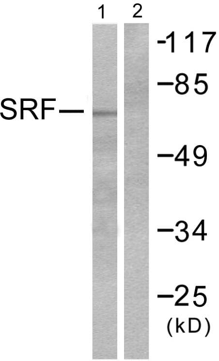 SRF / Serum Response Factor Antibody (p99)