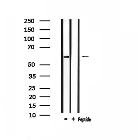 AATF Antibody