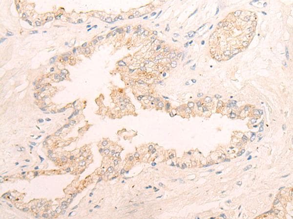 HNE / Neutrophil Elastase Antibody