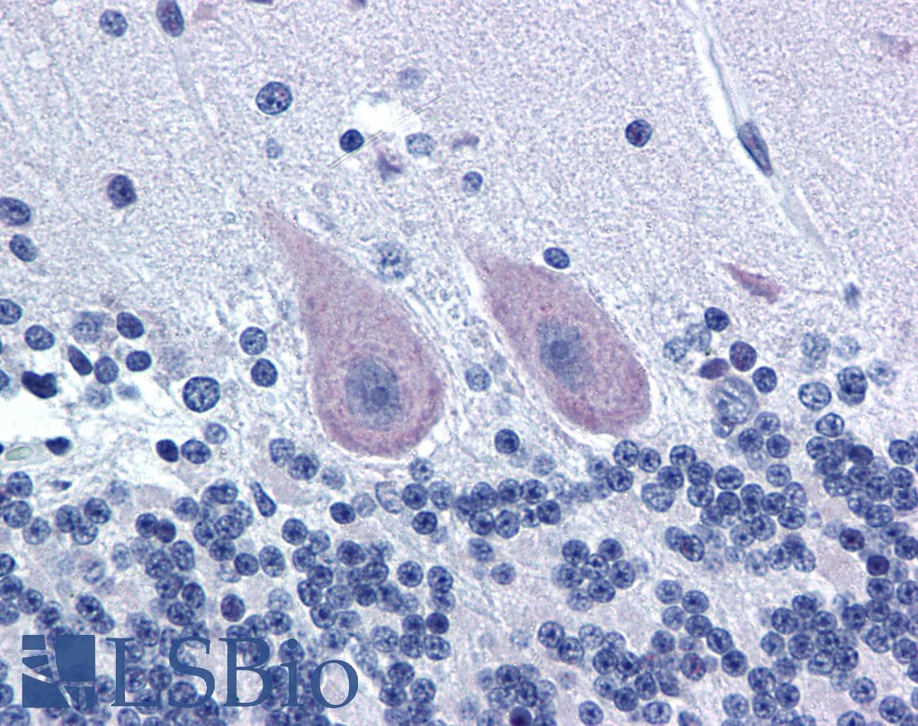 IHC-plus™ Polyclonal Rabbit anti-Human GRM1 / MGLUR1 Antibody (C-Terminus, IHC, WB)