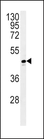 Polyclonal Rabbit anti-Human ADH1C Antibody (aa231-260, IHC, IF, WB)