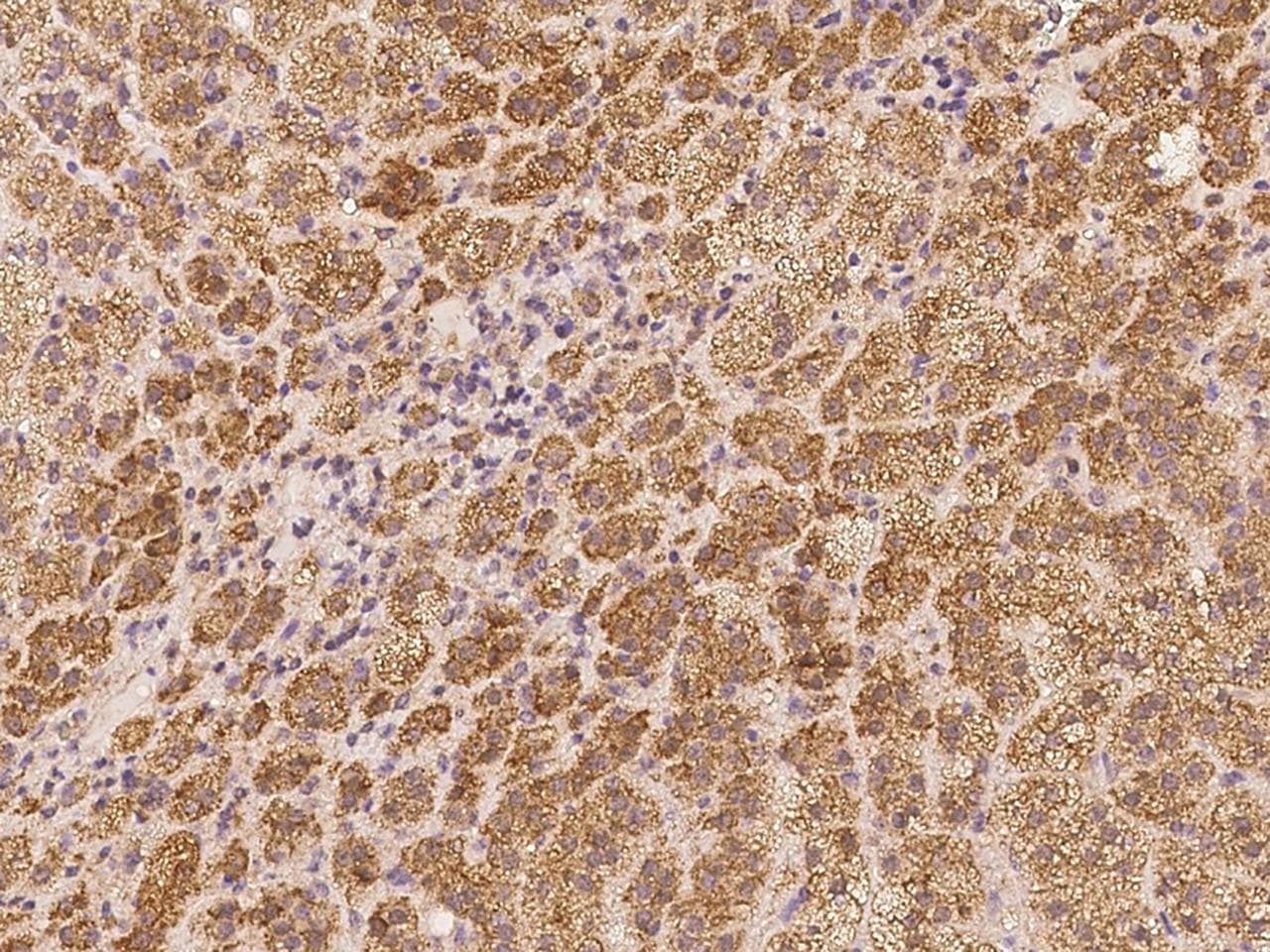 Polyclonal Rabbit anti-Human EXOC6 / SEC15 Antibody (IHC)