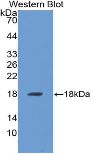 ALK3 / BMPR1A Antibody (aa24-152)