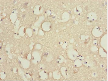 KBTBD7 Antibody