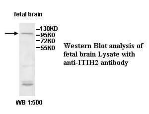 ITIH2 Antibody (aa124-321)