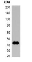 GST Tag Antibody