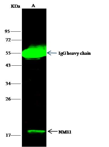 Polyclonal Rabbit anti-Human NME1 / NM23 Antibody (Preservative Free, IF, WB)