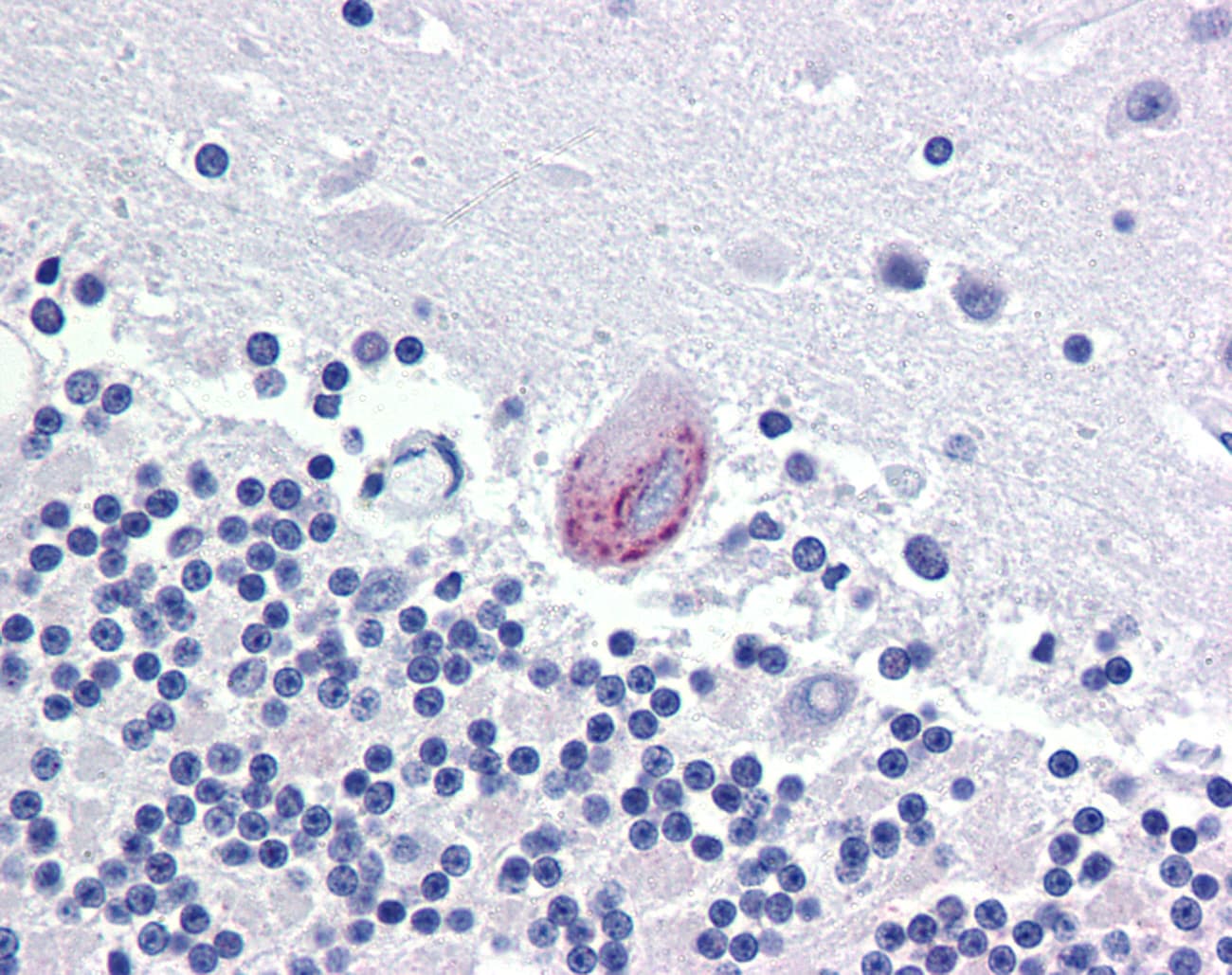 IHC-plus™ LPCAT1 / AYTL2 Antibody (Internal)