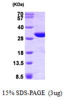 Human GSTO1 Protein (Recombinant)