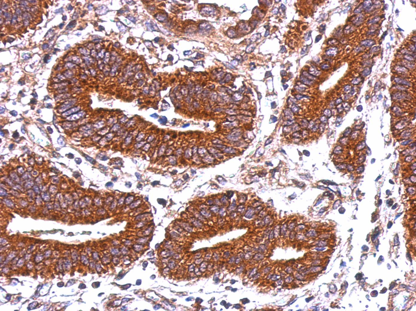 HLA-DQB2 Antibody