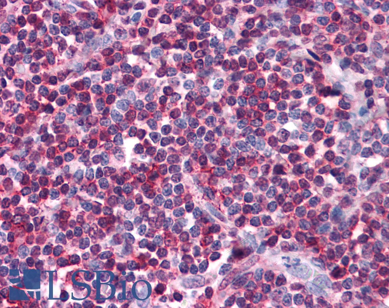 IHC-plus™ Monoclonal Mouse anti-Human SELPLG / PSGL-1 / CD162 Antibody (clone TC2, IHC)
